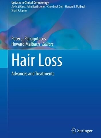 Hair Loss: Advances and Treatments