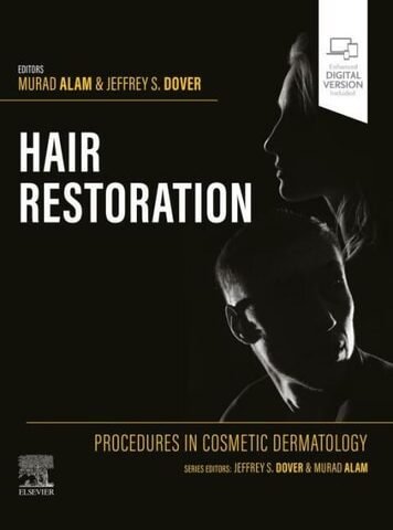 Procedures in Cosmetic Dermatology: Hair Restoration